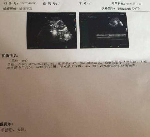 journal_insert_pic_591556776