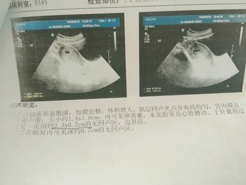 journal_insert_pic_594214202