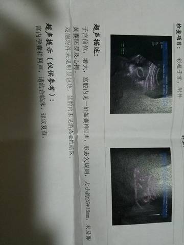 journal_insert_pic_595735955