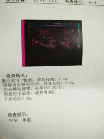 journal_insert_pic_597181029