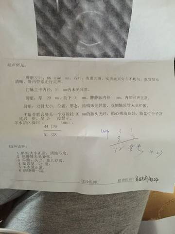 journal_insert_pic_598136904
