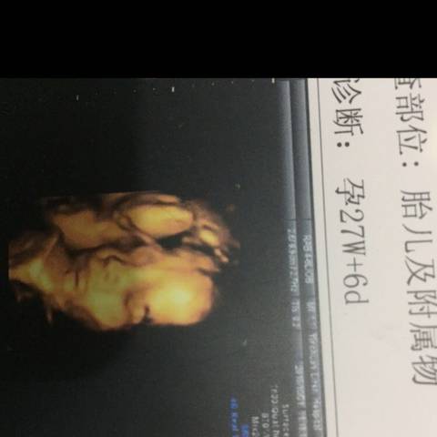 journal_insert_pic_600847938