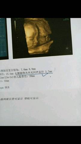 journal_insert_pic_600999474