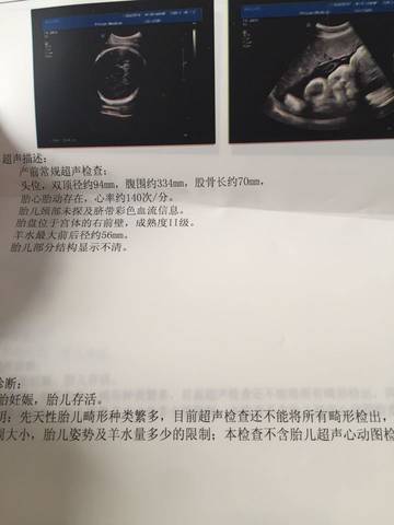journal_insert_pic_602231066