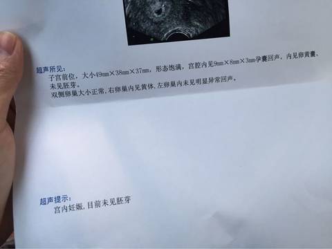 journal_insert_pic_602934793