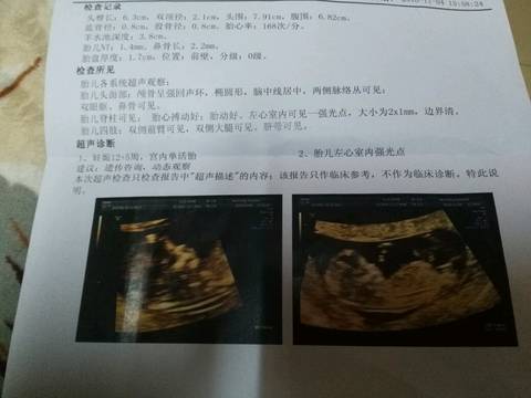 journal_insert_pic_602945800