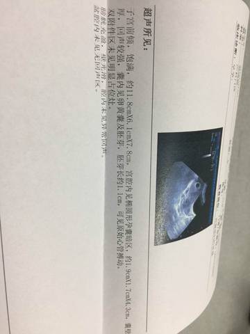 journal_insert_pic_602785810