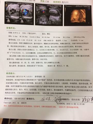journal_insert_pic_604138404
