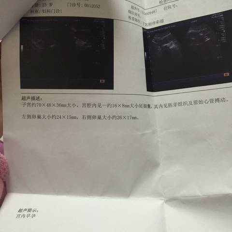 journal_insert_pic_606171994