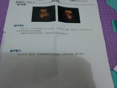 journal_insert_pic_608739618