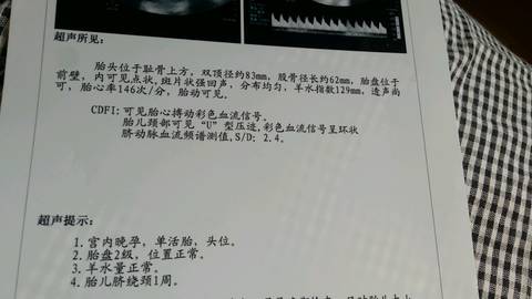 journal_insert_pic_609689490