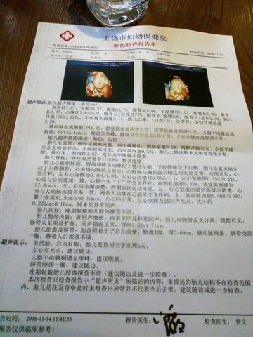 journal_insert_pic_609522729