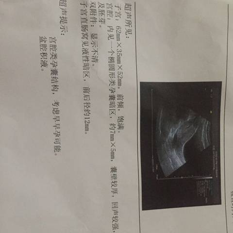 journal_insert_pic_612094502