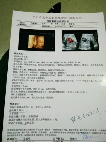 胎儿鼻骨短小图片