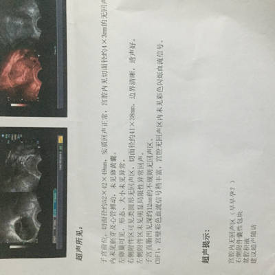 journal_insert_pic_615605045