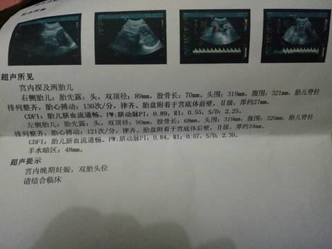 journal_insert_pic_615674191