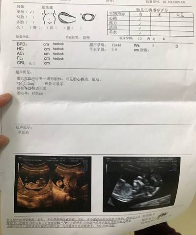 journal_insert_pic_616386243