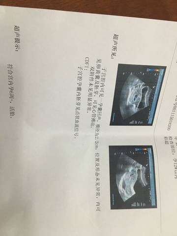 journal_insert_pic_616592320