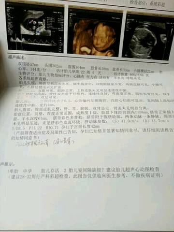 journal_insert_pic_616315078