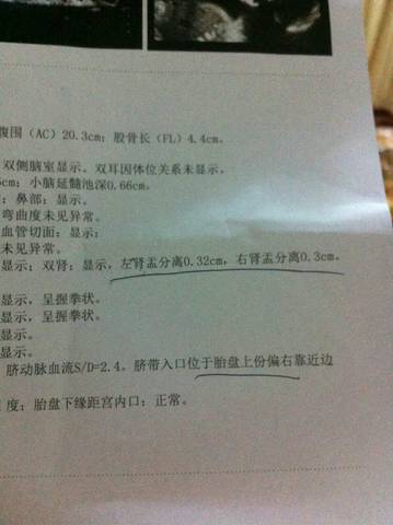 journal_insert_pic_617176332