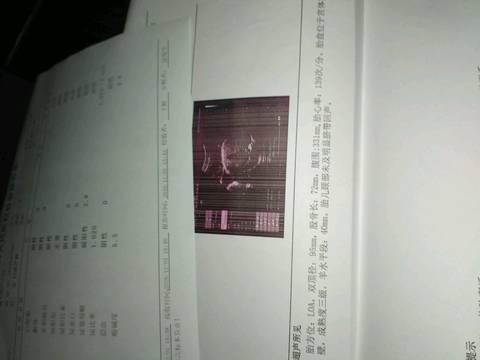journal_insert_pic_618331874