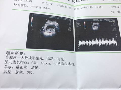 journal_insert_pic_619359733
