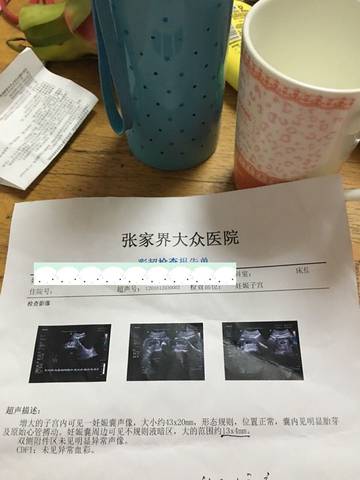 journal_insert_pic_620401694