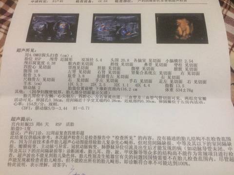 journal_insert_pic_621850625