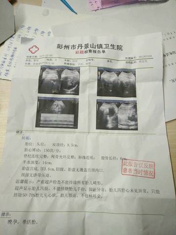 journal_insert_pic_622481827