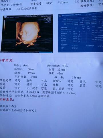 journal_insert_pic_622827554