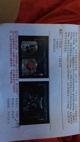 journal_insert_pic_627476920