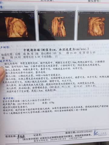 journal_insert_pic_628298203