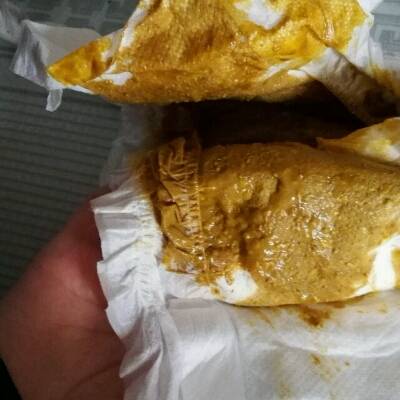 宝宝这几天吐奶厉害几天拉一次大便,今天拉的和以前不一样有很多颗粒