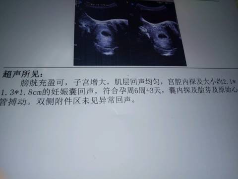 journal_insert_pic_630612903