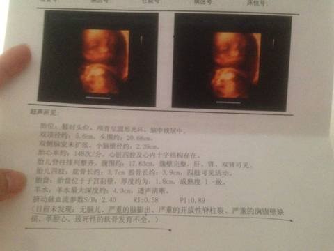 journal_insert_pic_631750769