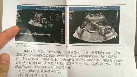 journal_insert_pic_631882213