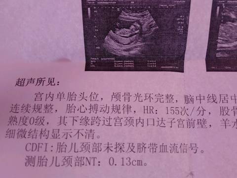 journal_insert_pic_631610576
