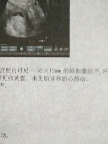 journal_insert_pic_633122530