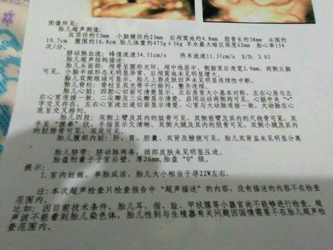 journal_insert_pic_633262542