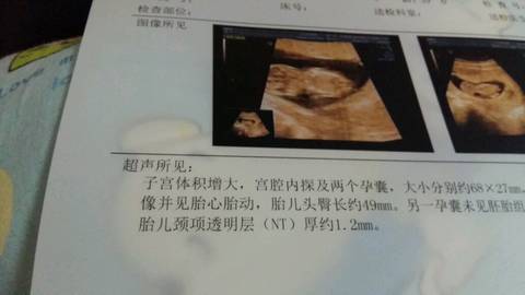 journal_insert_pic_632916727