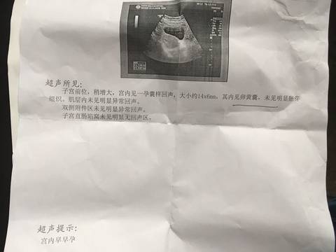 journal_insert_pic_633943130