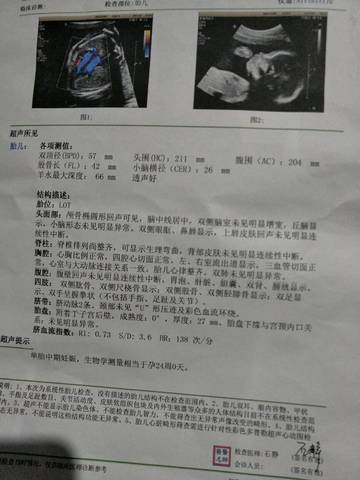 journal_insert_pic_635633141