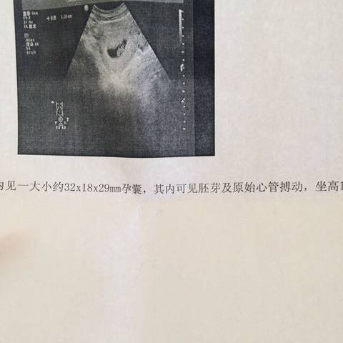journal_insert_pic_636082245