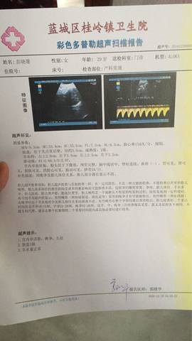 journal_insert_pic_637457322