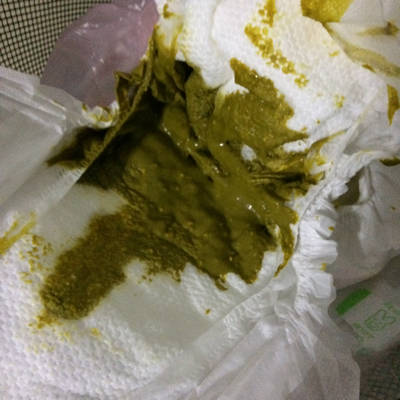 我家宝宝感冒了,但昨天窝的粑粑正常,今天成这个色了,不太懂求解