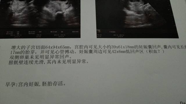 唐山妇科检查的全面解读与最新动态
