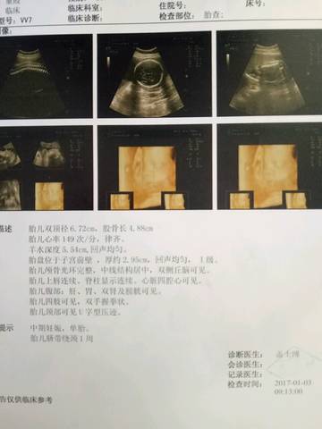 journal_insert_pic_640960159