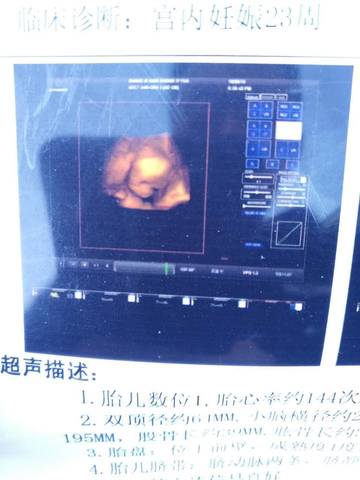 journal_insert_pic_640989215