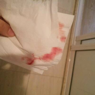 怀孕48天,去医院检查过两次第一次确诊怀孕但是没见孕囊 过了一个星期