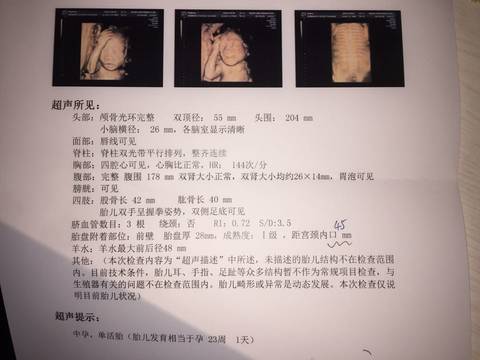 journal_insert_pic_641441864